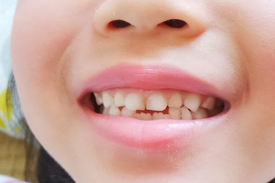 五反田駅前歯医者　小児歯科　乳歯の生える時期