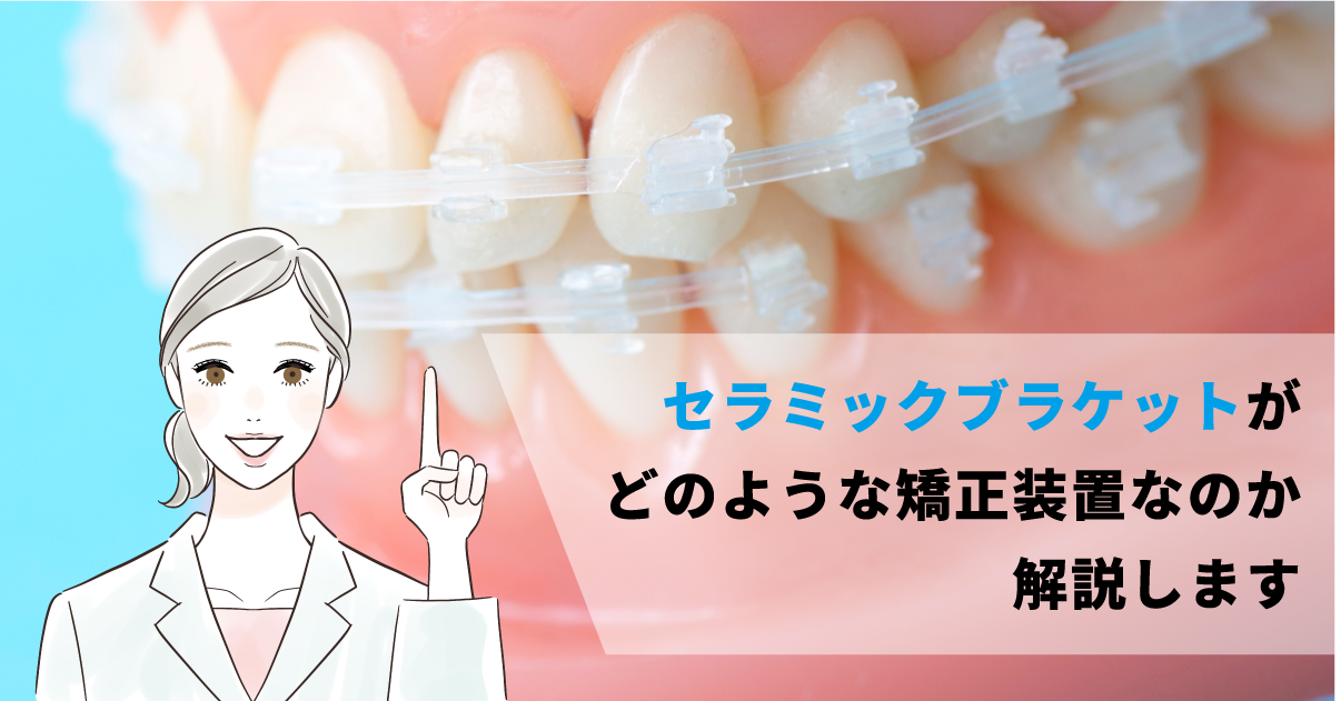 五反田で矯正歯科】セラミックブラケットがどのような矯正装置なのか
