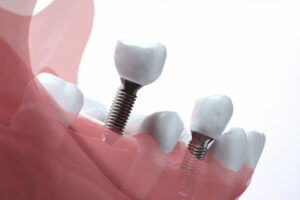 五反田駅前歯医者　